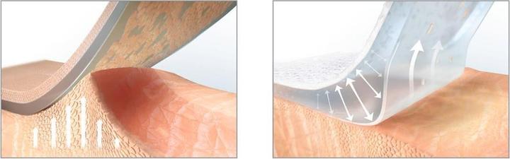 Actual product image Hansaplast Ultra Sensitive XL (5 x)
