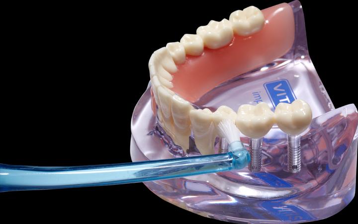 Immagine prodotto Dentaid Impianto Vitis Monotip Zb (1 x)