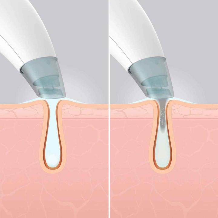 Produktbild Homedics Hydrafacial Cleanser