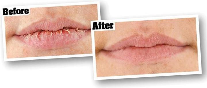Immagine prodotto O'Keeffe's Lip Repair Lippenbalsam (Balsamo)