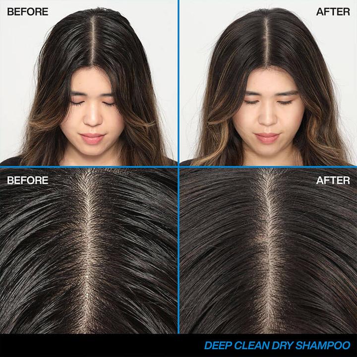 Image du produit Redken Shampooing sec Deep Clean (150 ml, Shampoing sec)