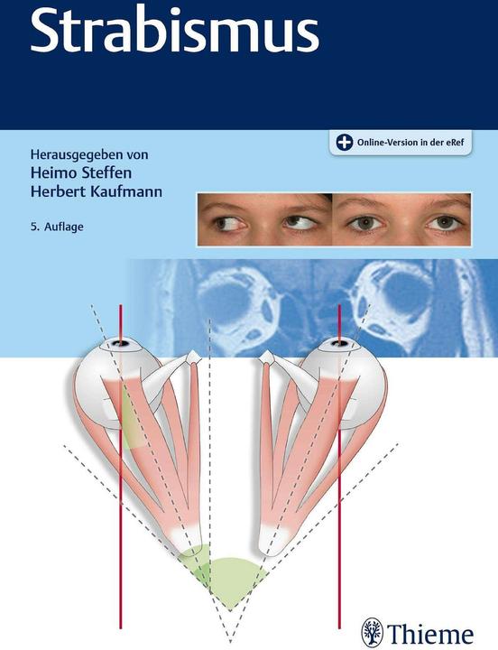 Produktbild Strabismus (Deutsch, Heimo Steffen, Herbert Kaufmann, 2020)
