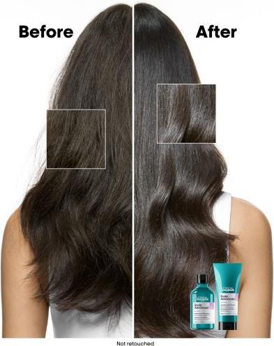 Actual product image L'Oréal Professionnel Series Expert Scalp Advanced Anti-Discomfort Dermo-Regulator Refill (500 ml, Liquid shampoo)