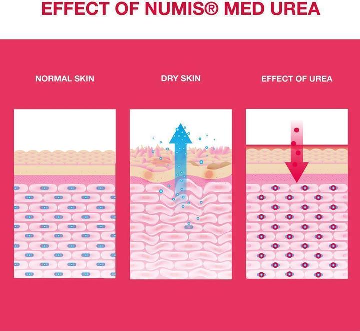Produktbild Numis Med UREA 5% Körperlotion (Körperlotion, 300 ml)