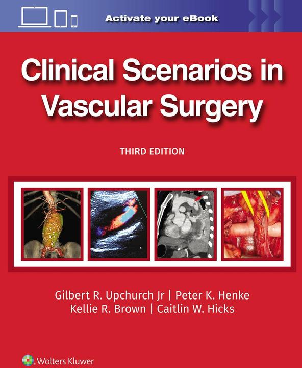 Produktbild Clinical Scenarios in Vascular Surgery (Englisch, Kellie R. Brown, Peter Henke, Gilbert R. Upchurch Jr., Caitlin W. Hicks, 2024)