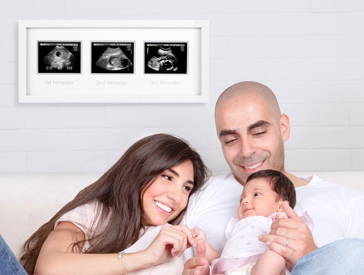 Produktbild Pearhead Rahmen Ultraschallbilder