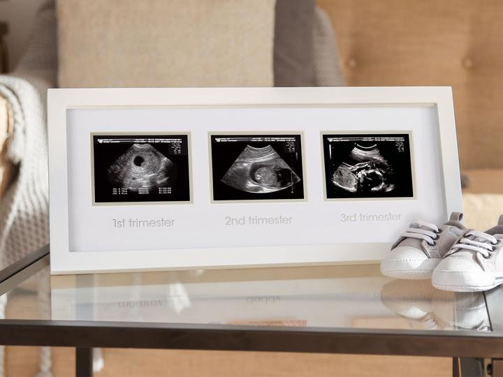 Produktbild Pearhead Rahmen Ultraschallbilder