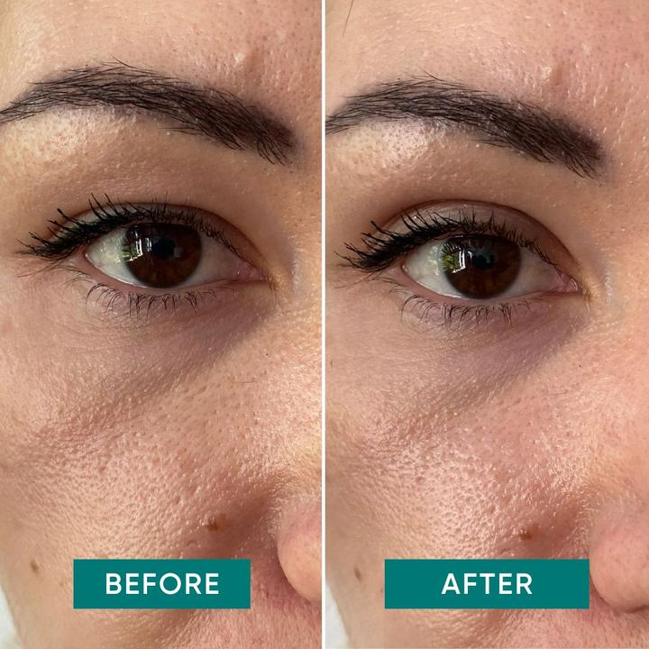 Image du produit Apricot Bye Sleepy Eye (Patchs)