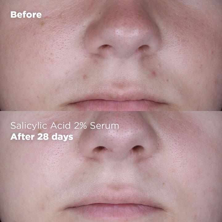 Produktbild Skin Republic Salicylic Acid 2% (30 ml)