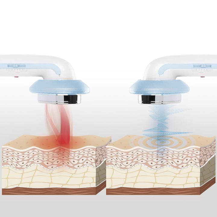 Produktbild InnovaGoods Massagegerät mit Ultraschall-Kavitation