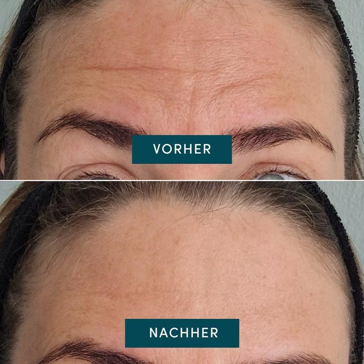 Actual product image Apricot wiederv. Stirn Pad Vitamin C "glow booster"