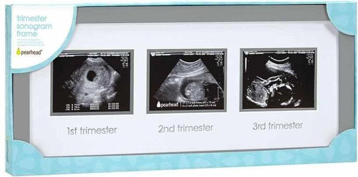 Produktbild Pearhead Rahmen Ultraschallbilder