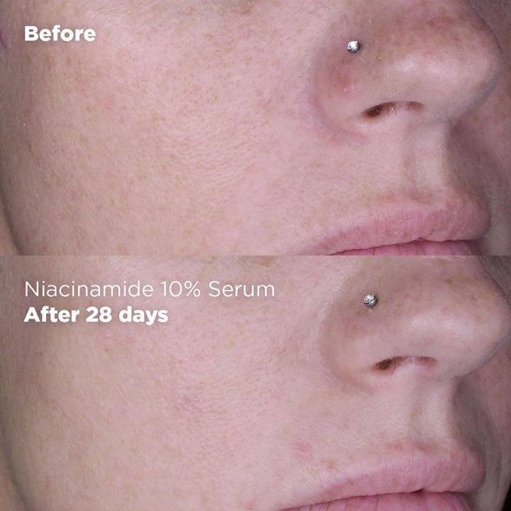 Immagine prodotto Skin Republic - Siero Niacinamide 10% + Zinco 1% (30 ml)
