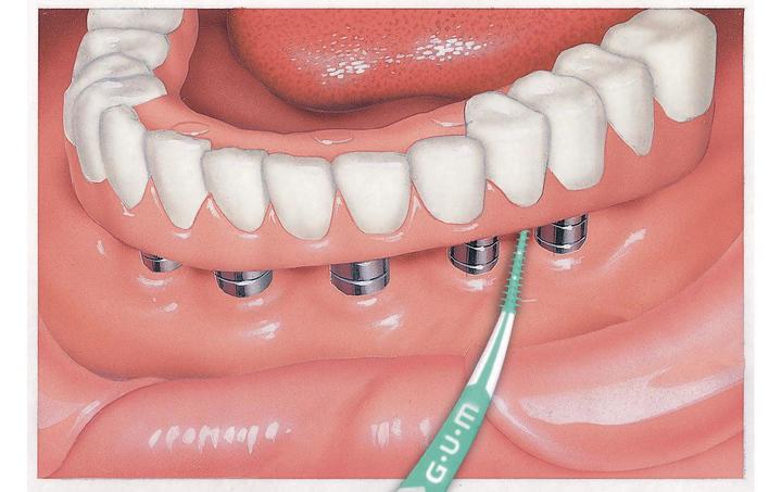 Productafbeelding GUM Soft Picks PRO Klein (1 x)