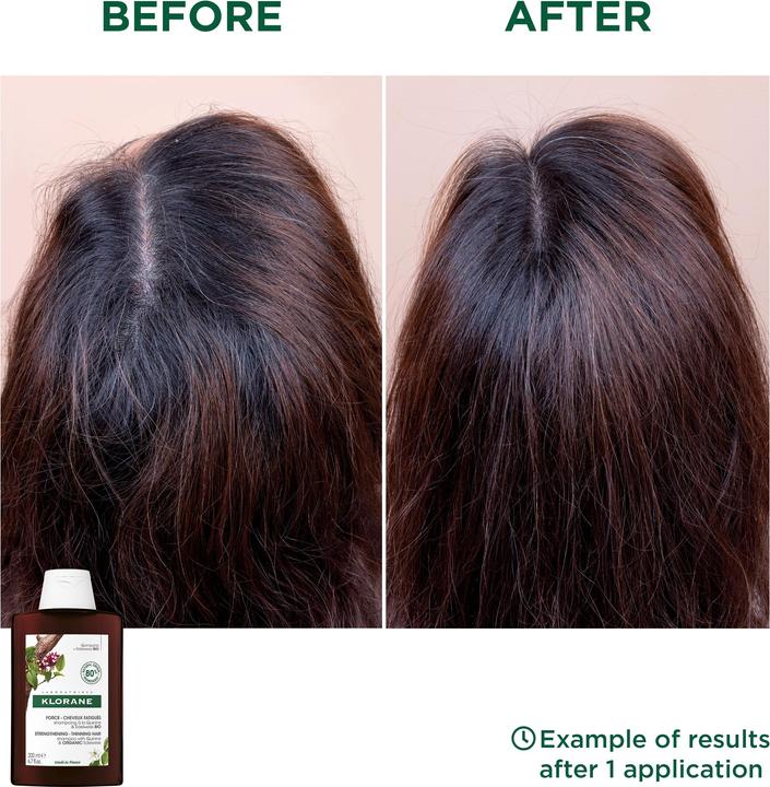 Produktbild Klorane Stärkendes mit Chinin und Bio-Edelweiss (200 ml, Flüssiges Shampoo)