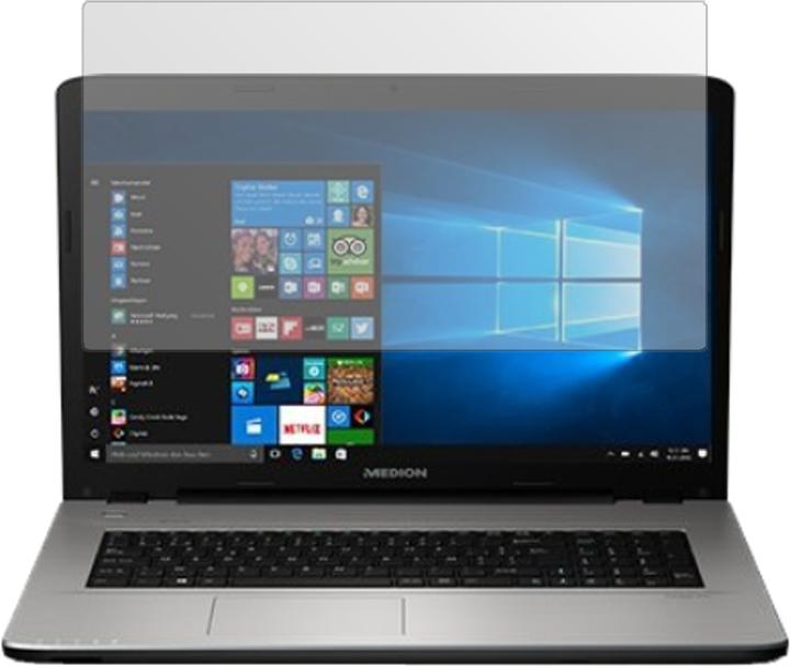 Produktbild Dipos Displayschutzfolie Antireflex (2 Stück, Akoya E7424)