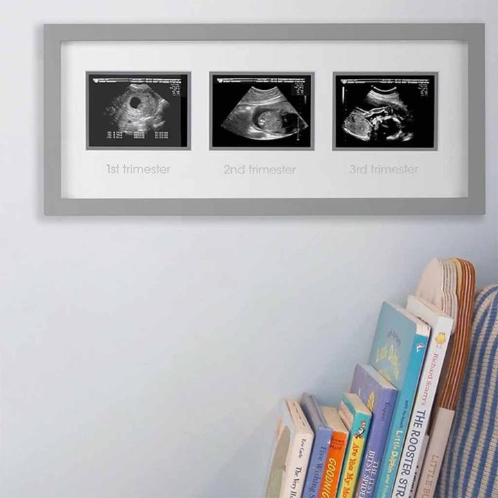 Produktbild Pearhead Rahmen Ultraschallbilder