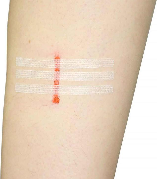 Actual product image Teqler Wound suture strips 6x100mm, 10 pcs. (10 x)