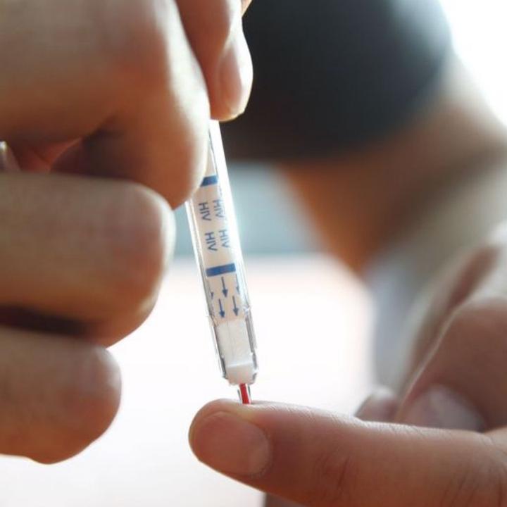 Produktbild Biosure HIV Self Test (1 x)