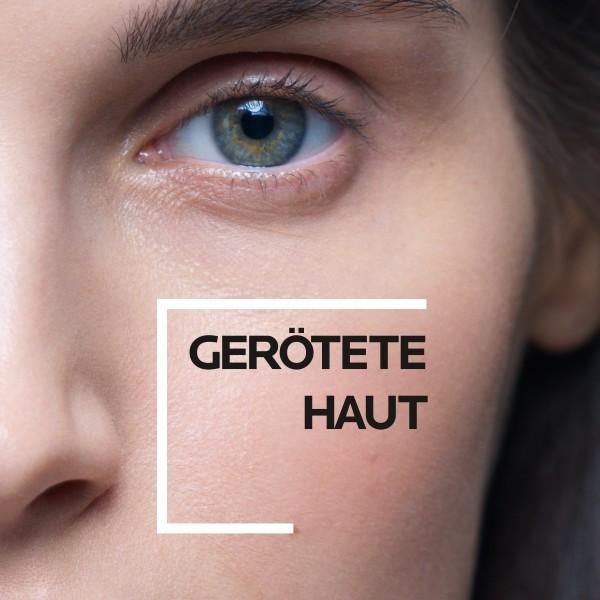 Actual product image La Roche Posay Toleriane Rosaliac AR Concentrate (40 ml, 24h cream)
