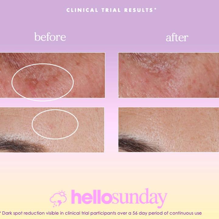 Actual product image Hello sunday the one that makes you glow Dark spot oil serum SPF 40 (30 ml)