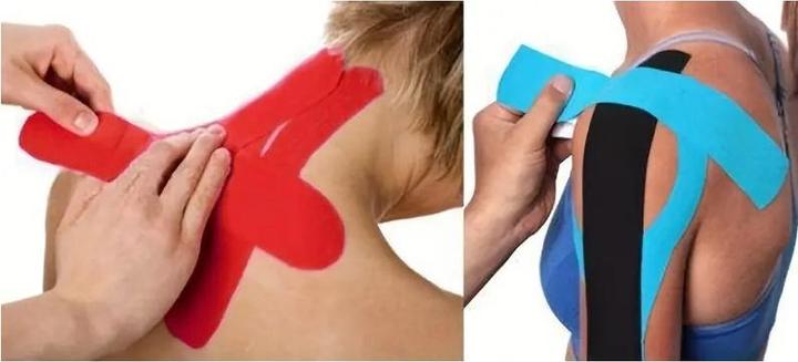 Immagine prodotto Cbx Nastro kinesiologico, nastro sportivo 5m (5 m)