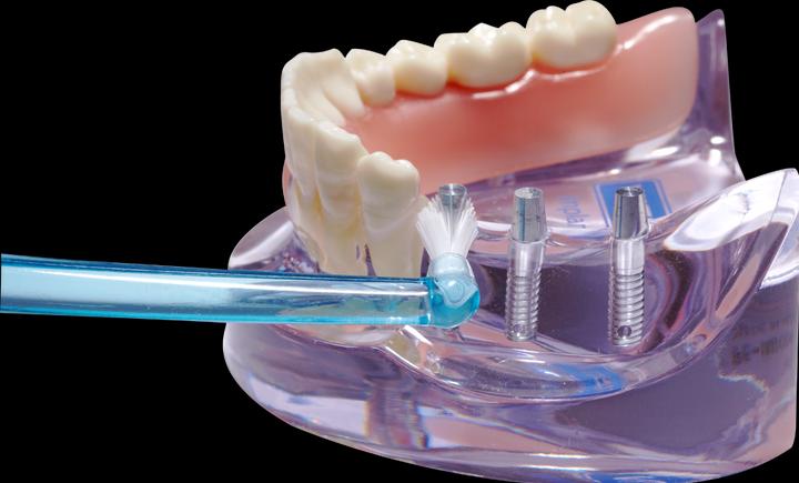 Immagine prodotto Dentaid Impianto Vitis Monotip Zb (1 x)