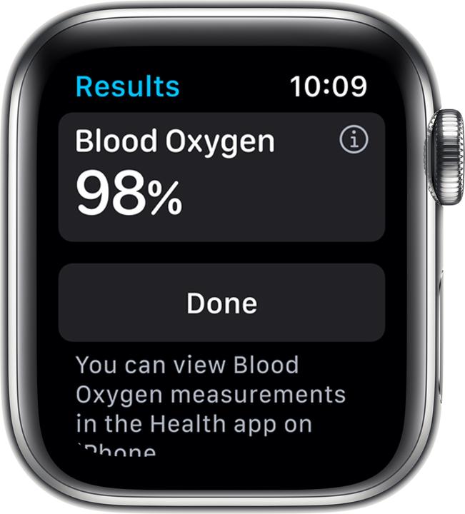 Actual product image Apple Watch Series 6 (40 mm, 4G)