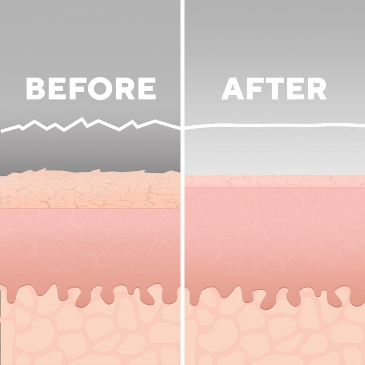 Actual product image Homedics MD-1000 Remove