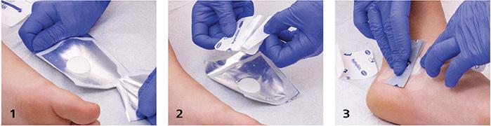 Immagine prodotto IVF Hartmann più cuscinetto per ferite ovale (798.46 ml)
