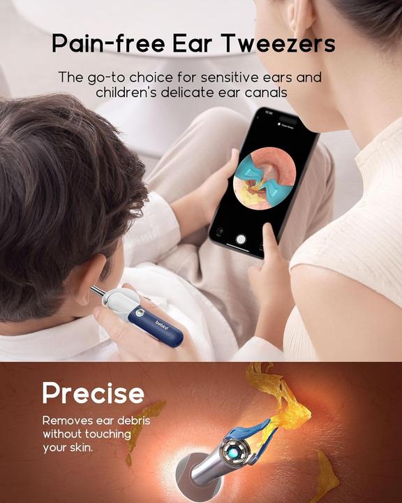 Produktbild Bebird EarSight Plus - Blue
