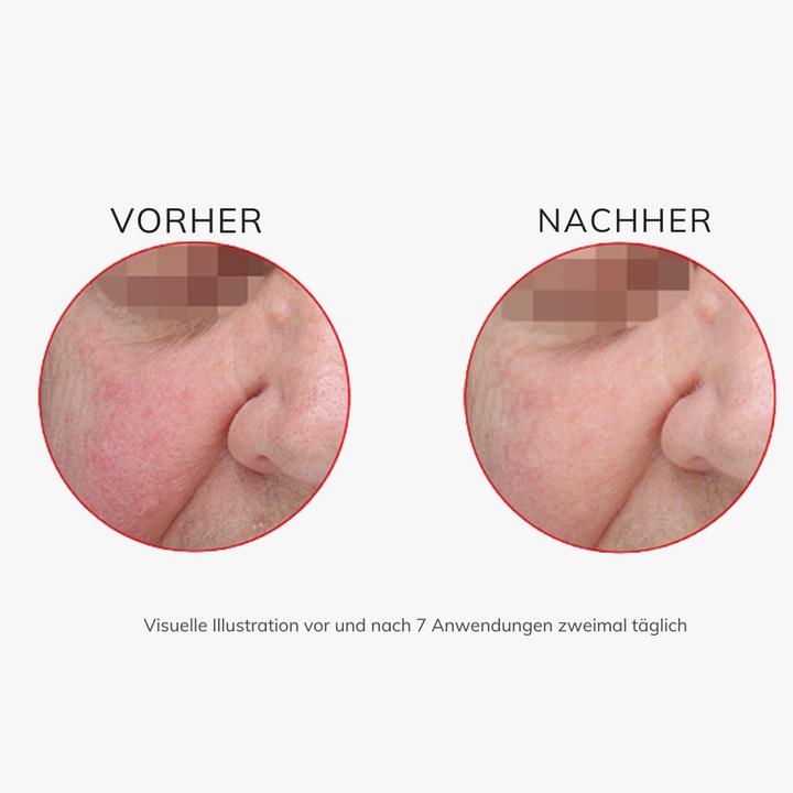 Actual product image Swissforce Anti-redness (30 ml, Face balm)