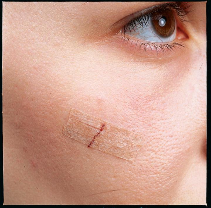 Produktbild Nexcare Steri-Strip Wundverschlussstreifen (6 x)