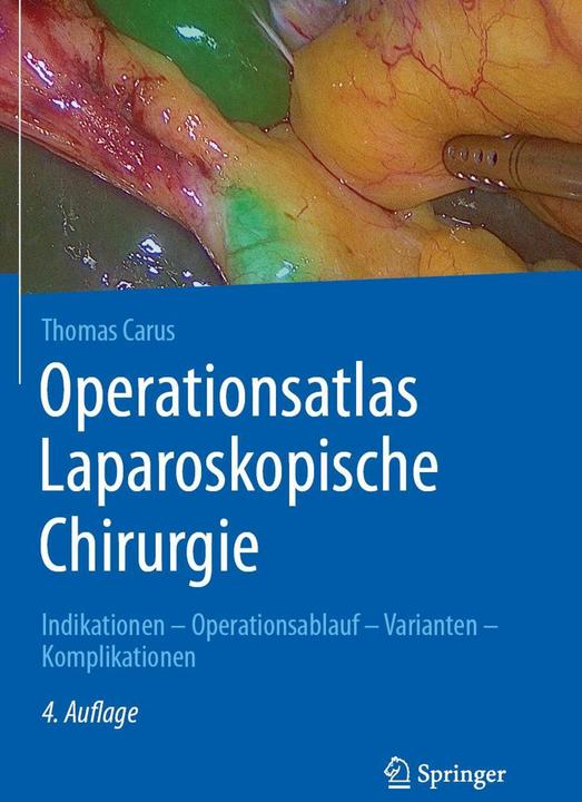 Actual product image Operationsatlas Laparoskopische Chirurgie (German, Thomas Carus, 2024)