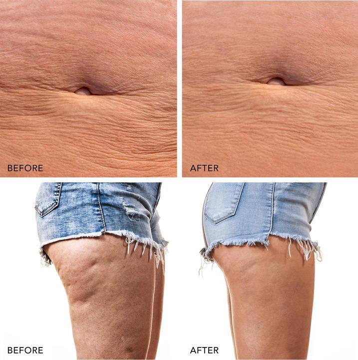 Produktbild Foreo Mikrostromgerät