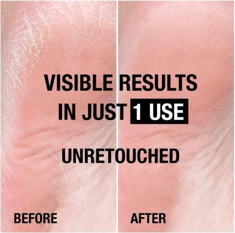 Produktbild Neutrogena Reichhaltige Fusscreme (Fusscrème & Fussgel, 100 ml)
