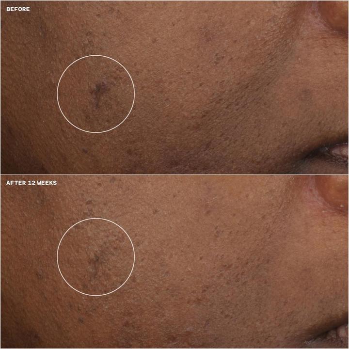 Actual product image Clinique Even Better Clin Brightness Moisturizer (15 ml)