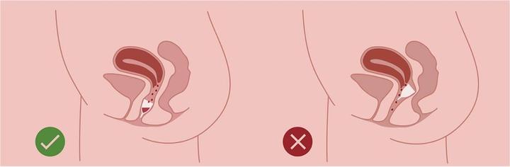 Image du produit AllMatters OrganiCup Cup menstruelle, taille A (Normal)