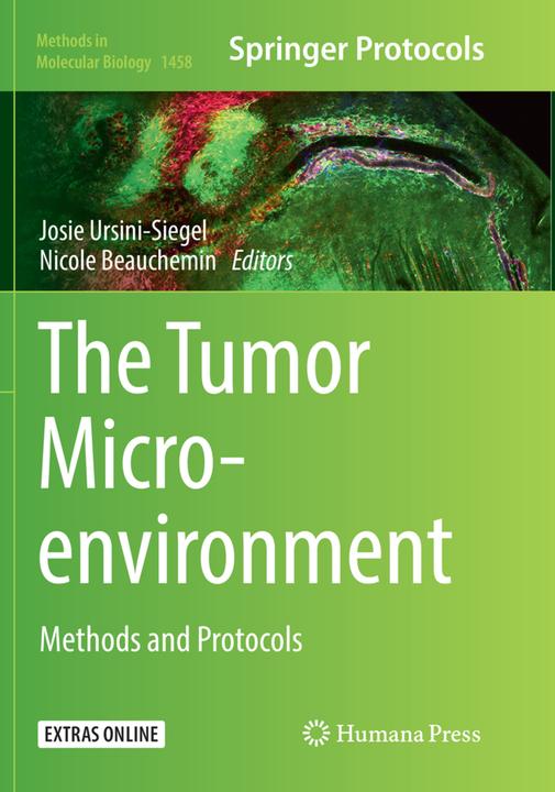 Actual product image The Tumor Microenvironment (Nicole Beauchemin, Josie Ursini-Siegel, 2018)