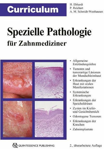 Curriculum Spezielle Pathologie für Zahnmediziner (German, Harald Ebhardt, Peter A. Reichart, Andrea Maria Schmidt-Westhausen, 2018)