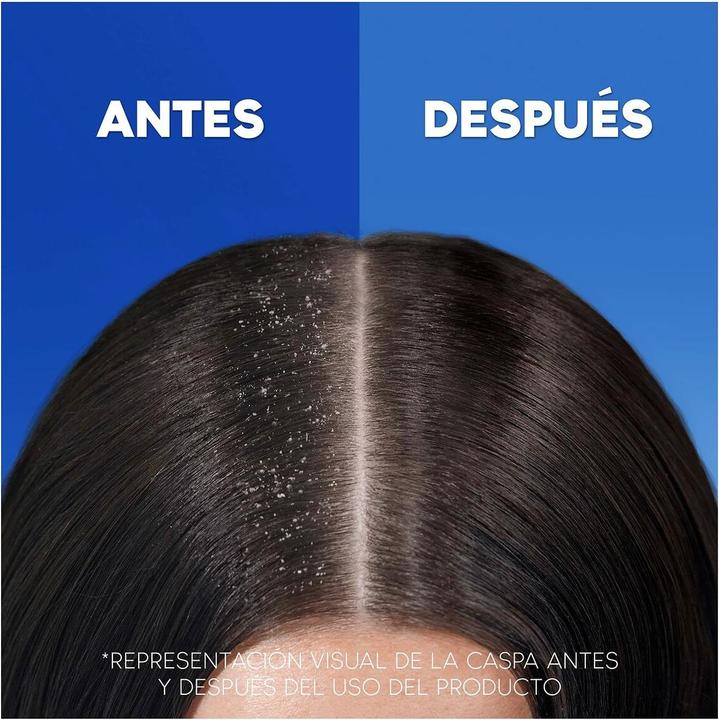 Actual product image Head & Shoulders H&S Classic Shampoo 900ml (1000 ml, Liquid shampoo)
