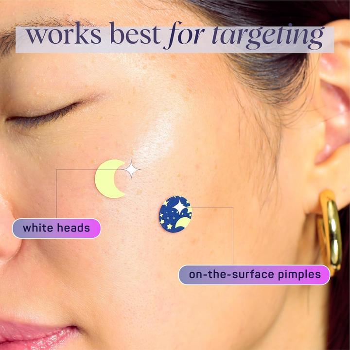 Actual product image SpaLife Pimple Patch Hydrocolloid luminous