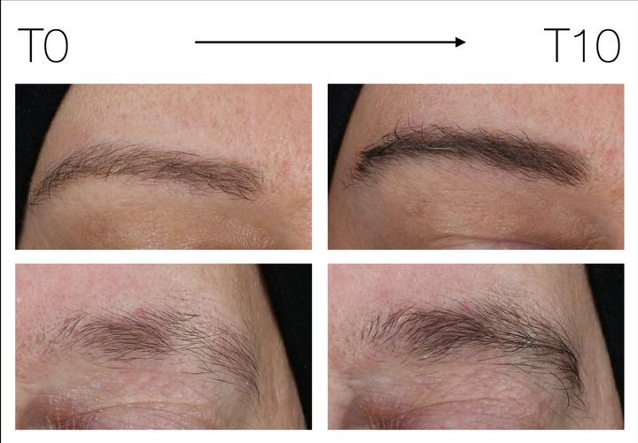Produktbild BeautyLash Augenbrauenserum Eyebrow Growth Booster (4 ml)