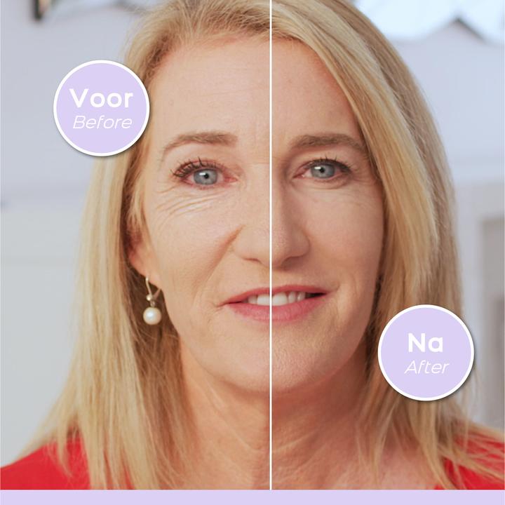 Actual product image Agefit Anti-Wrinkle Serum - Anti-Wrinkle Eye Cream For Skin Care (Eye care serum, Day)