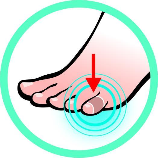 Actual product image Sidas Toe Protector 5x (5 x)
