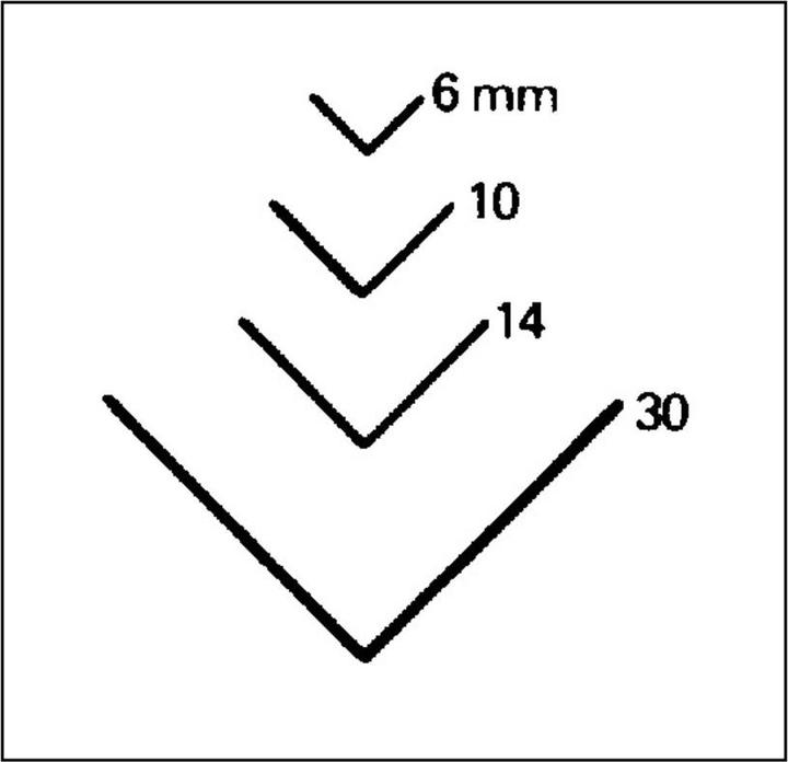 Immagine prodotto Ferro da stiro a forma dritta (4 mm)