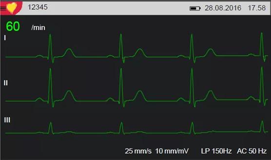 Immagine prodotto ECG a riposo Cardiovit AT-1 G2 con opzione di interpretazione