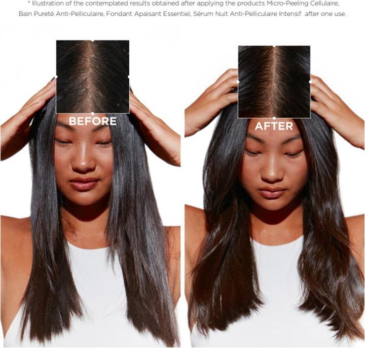 Actual product image Kérastase Symbiose Micro-Peeling Cellulaire (200 ml, Liquid shampoo)