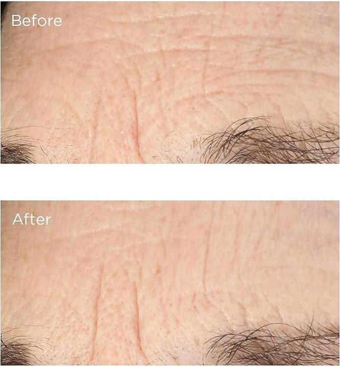 Produktbild Perricone MD Essential Fx Acyl-Glutathione: Deep Crease Gesichtsserum 30 ml Frauen Rose (30 ml)