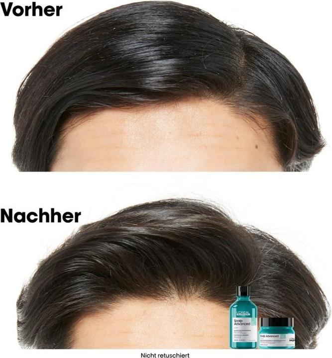 Immagine prodotto L'Oréal Professionnel Scalp Advanced (250 ml)